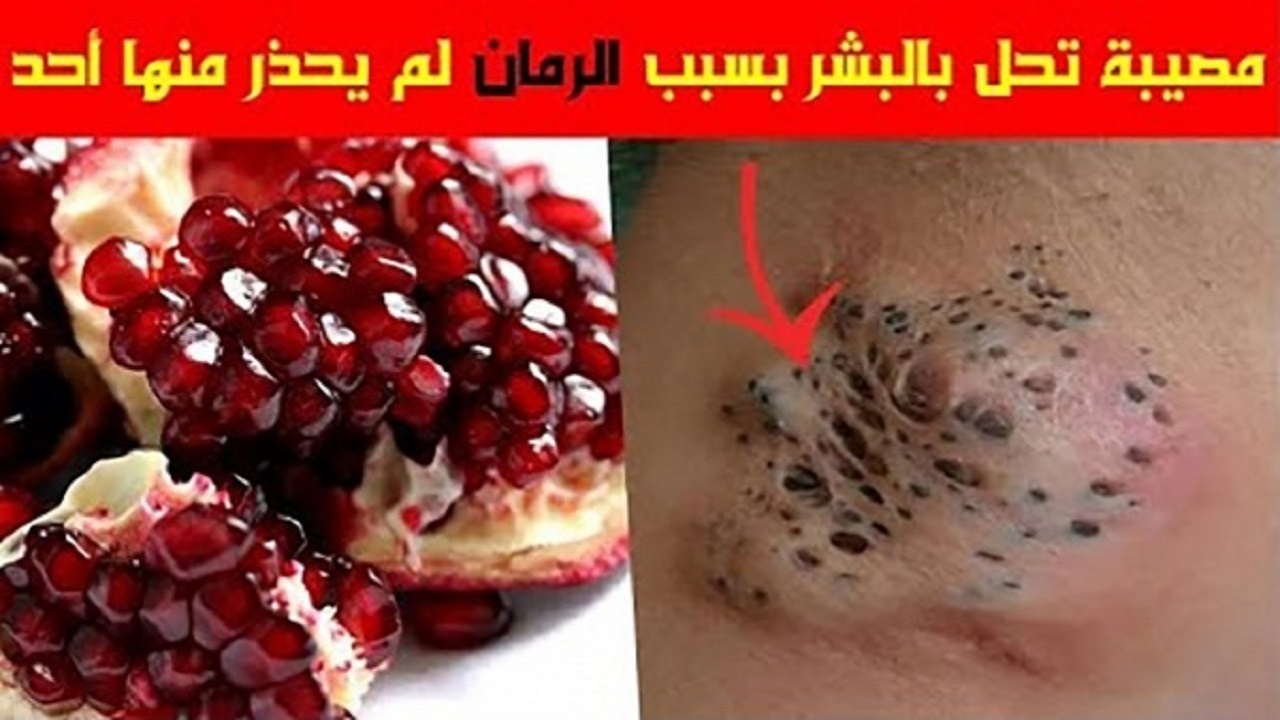 الأطباء يحذرون كارثة صحية بسبب الرمان احذروها قبل فوات الأوان كيف يصبح الرمان سبب هلاكنا