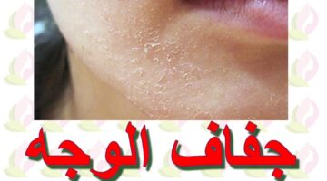 وصفات طبيعية لجفاف البشرة