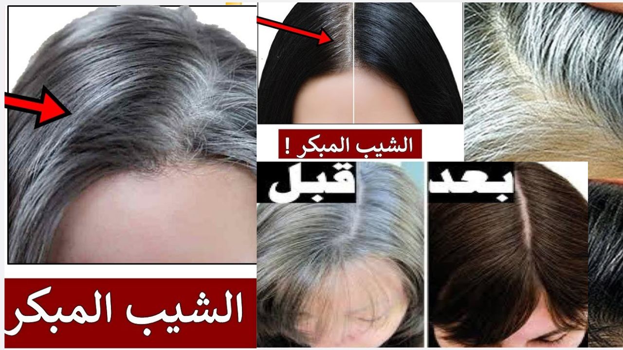 ودعي الشعر الأبيض نهائيًا بوصفة طبيعية تعيد لك لون شعرك الأصلي بسهولة وبمكونات بمنزلك