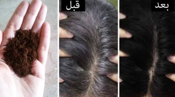 التخلص من الشعر الأبيض