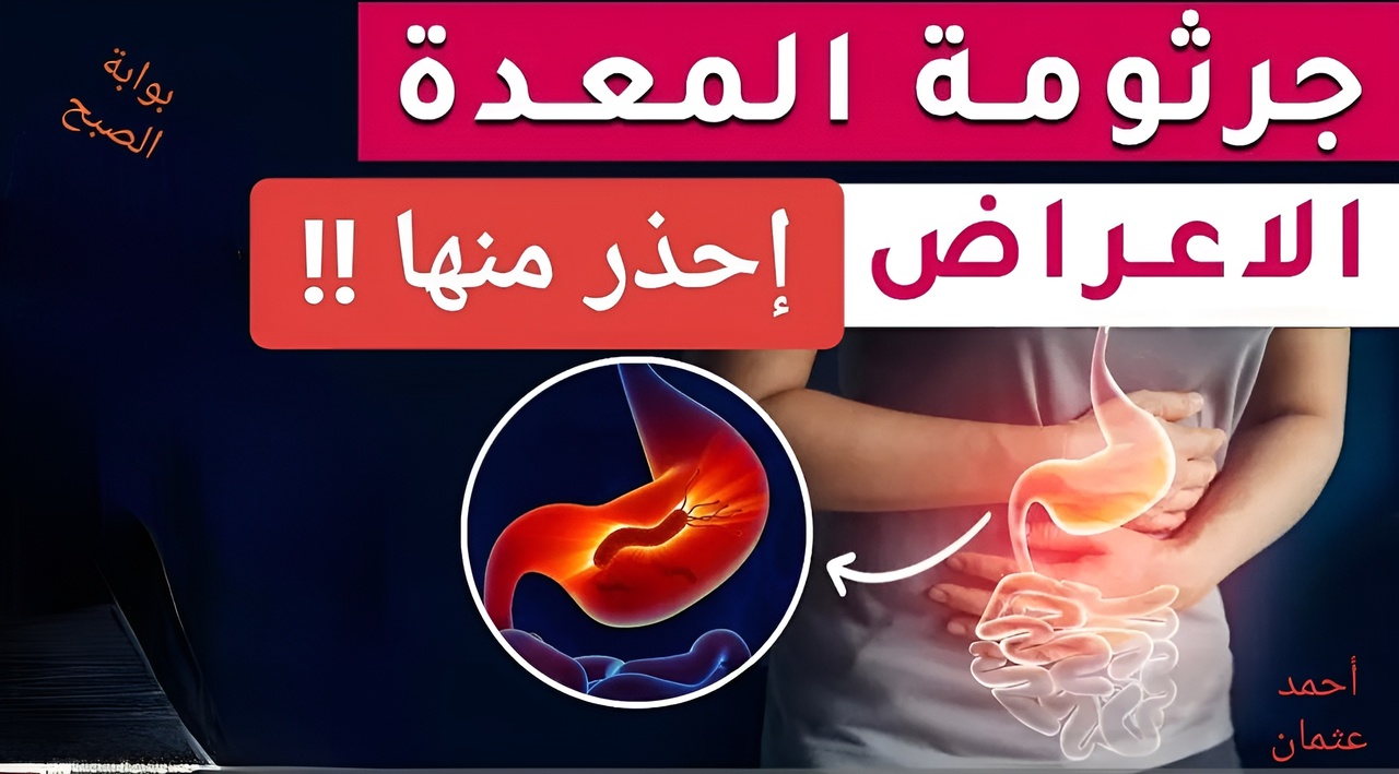 "إحذر منها !!".. علامات الإصابة بجرثومة المعدة لا تتجاهلها قبل فوات الآوان ومتى يجب عليك إستشارة الطبيب ؟ 5 “إحذر منها !!”.. علامات الإصابة بجرثومة المعدة لا تتجاهلها قبل فوات الآوان ومتى يجب عليك إستشارة الطبيب ؟