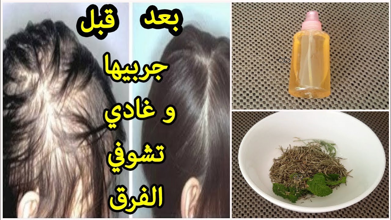 هيطول بجنون.. مكون ضعيه على القهوة لتطويل الشعر وتكثيفه بأسرع وقت 2 هيطول بجنون.. مكون ضعيه على القهوة لتطويل الشعر وتكثيفه بأسرع وقت