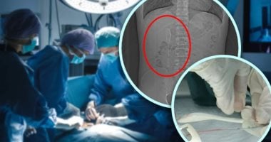 صيني ثمل يلتهم ملعقة معتقدًا أنها حلم ليكتشف الحقيقة بعد خمسة أشهر